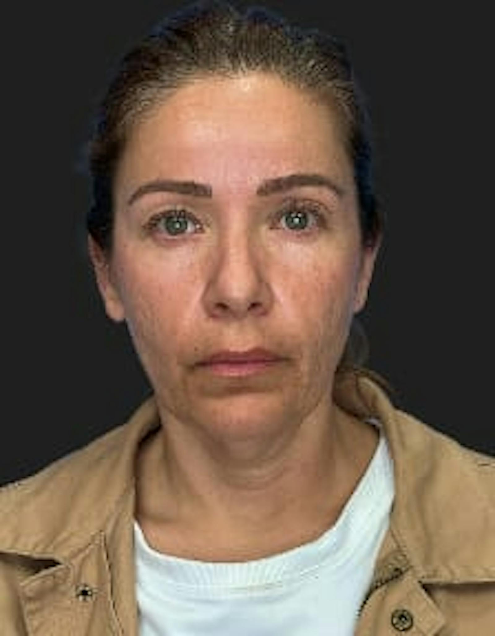 Patient 2, before number 1
