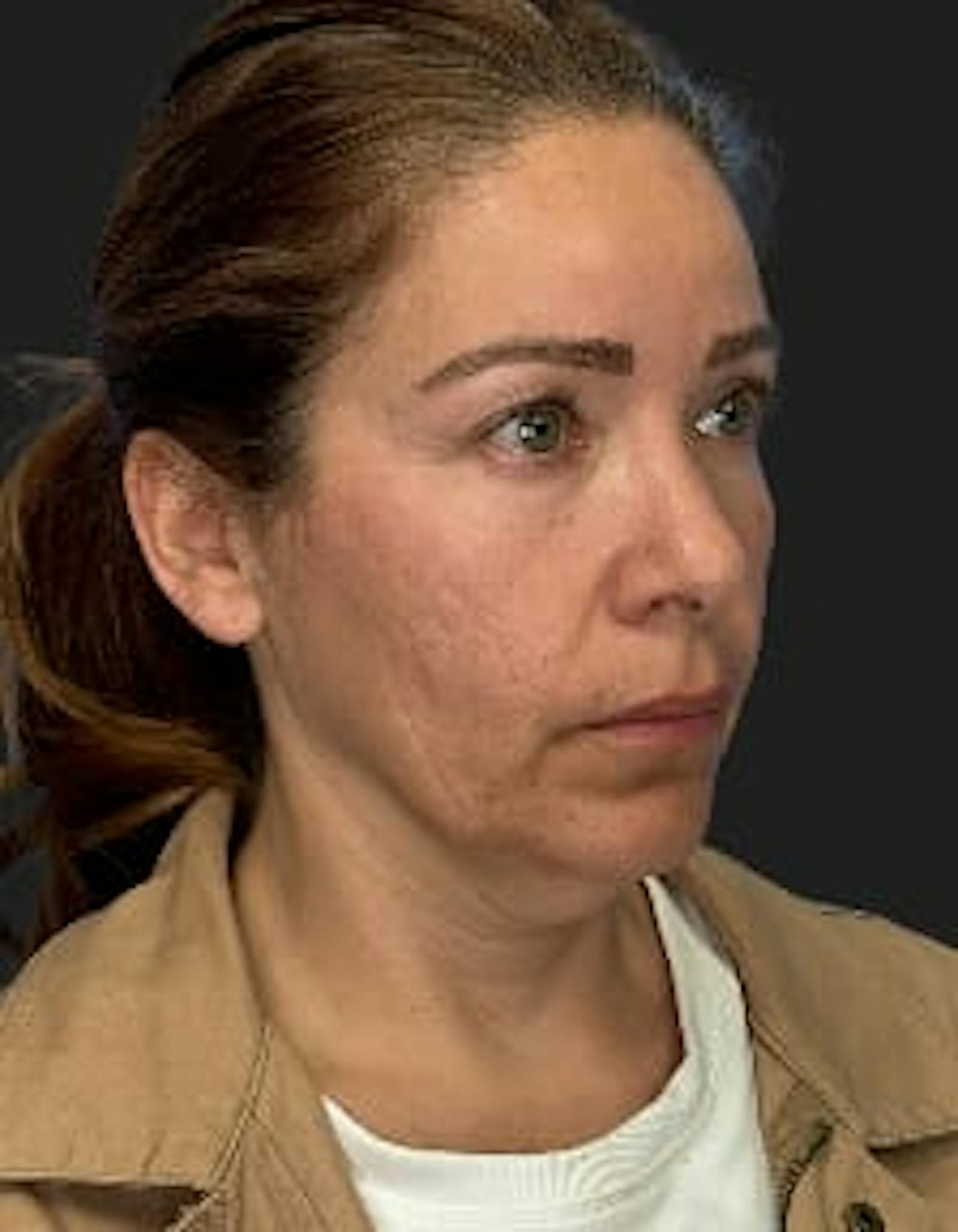 Patient 2, before number 2