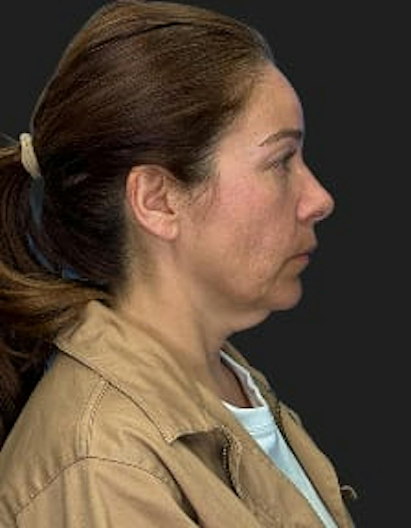 Patient 2, before number 3