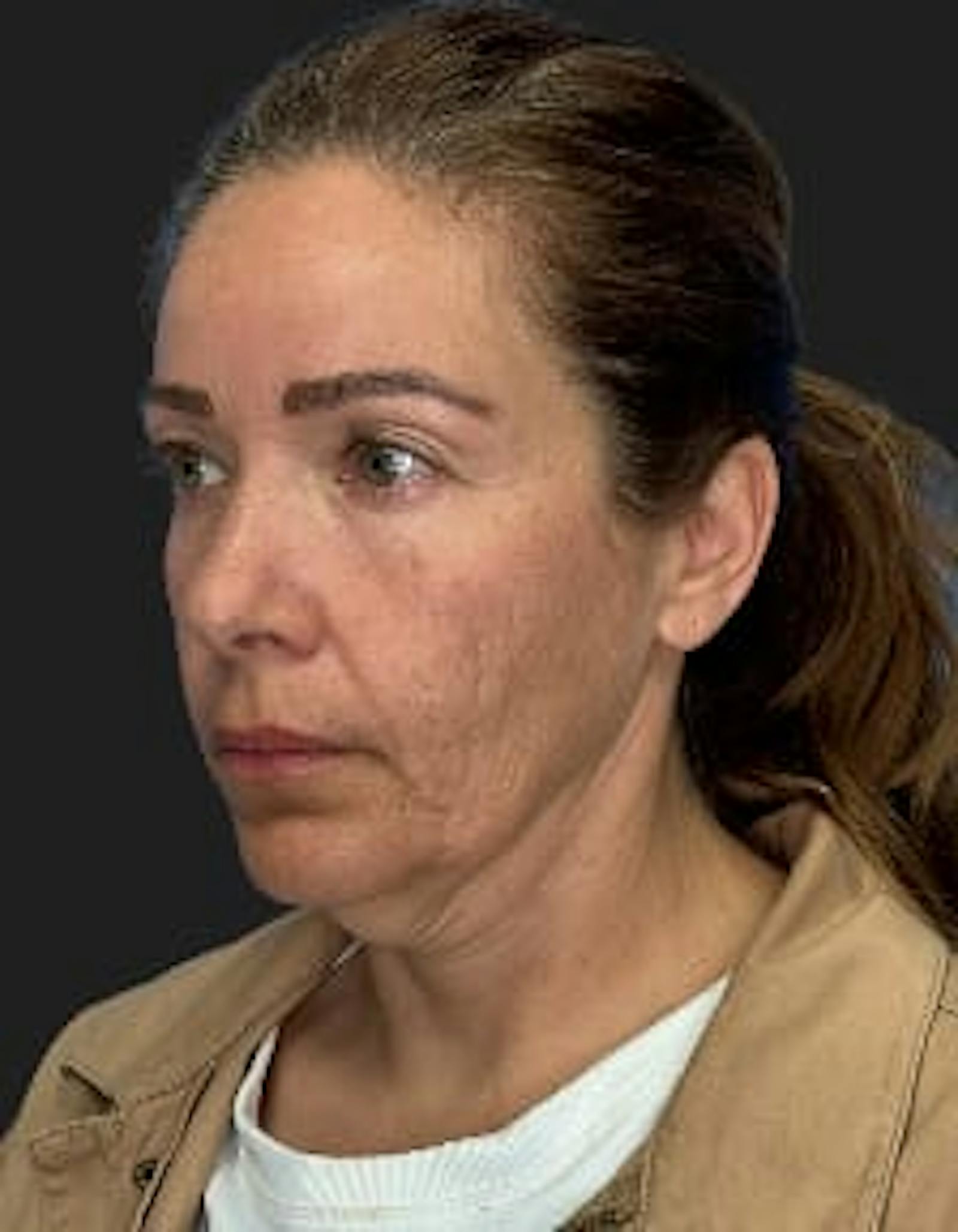 Patient 2, before number 4