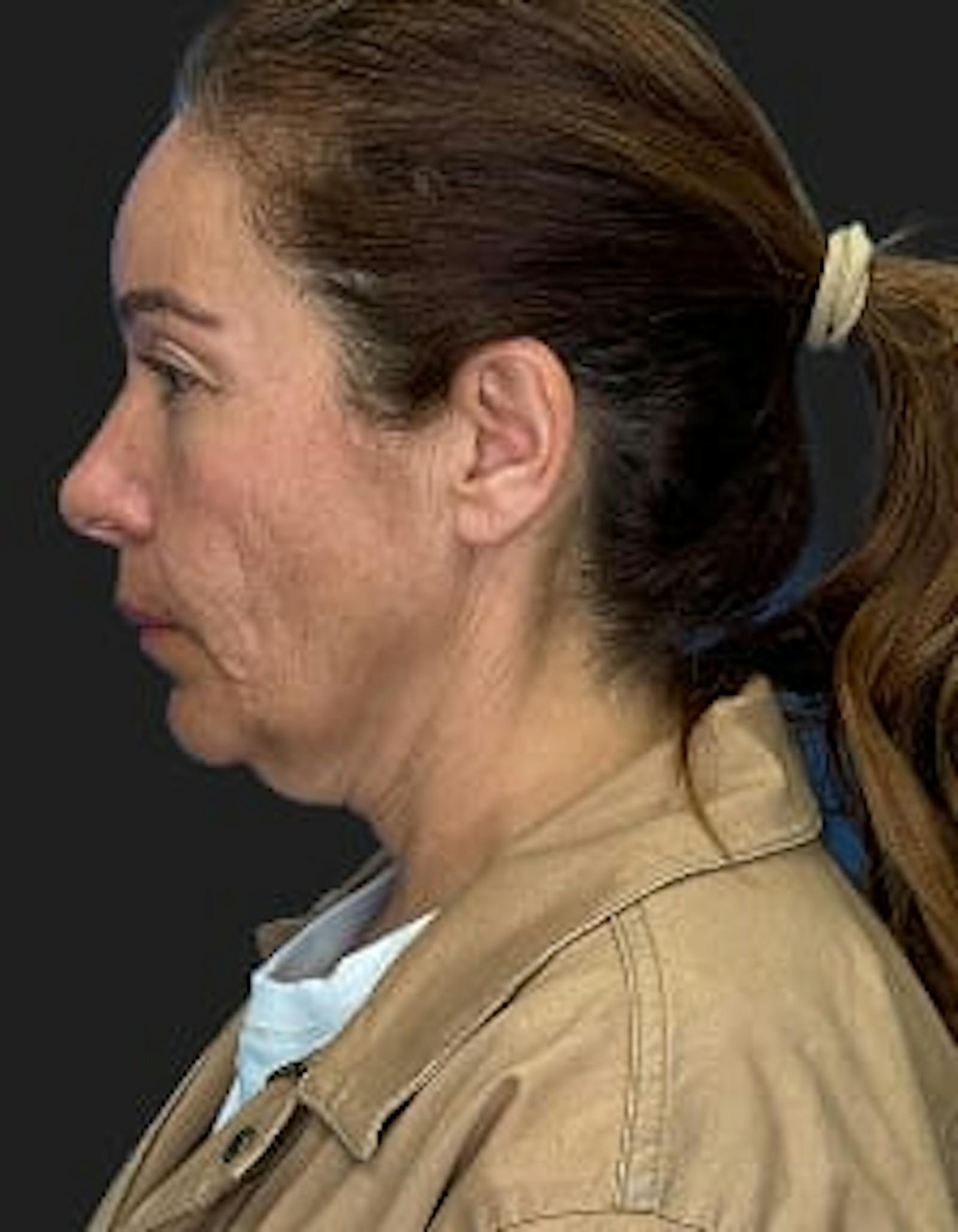 Patient 2, before number 5