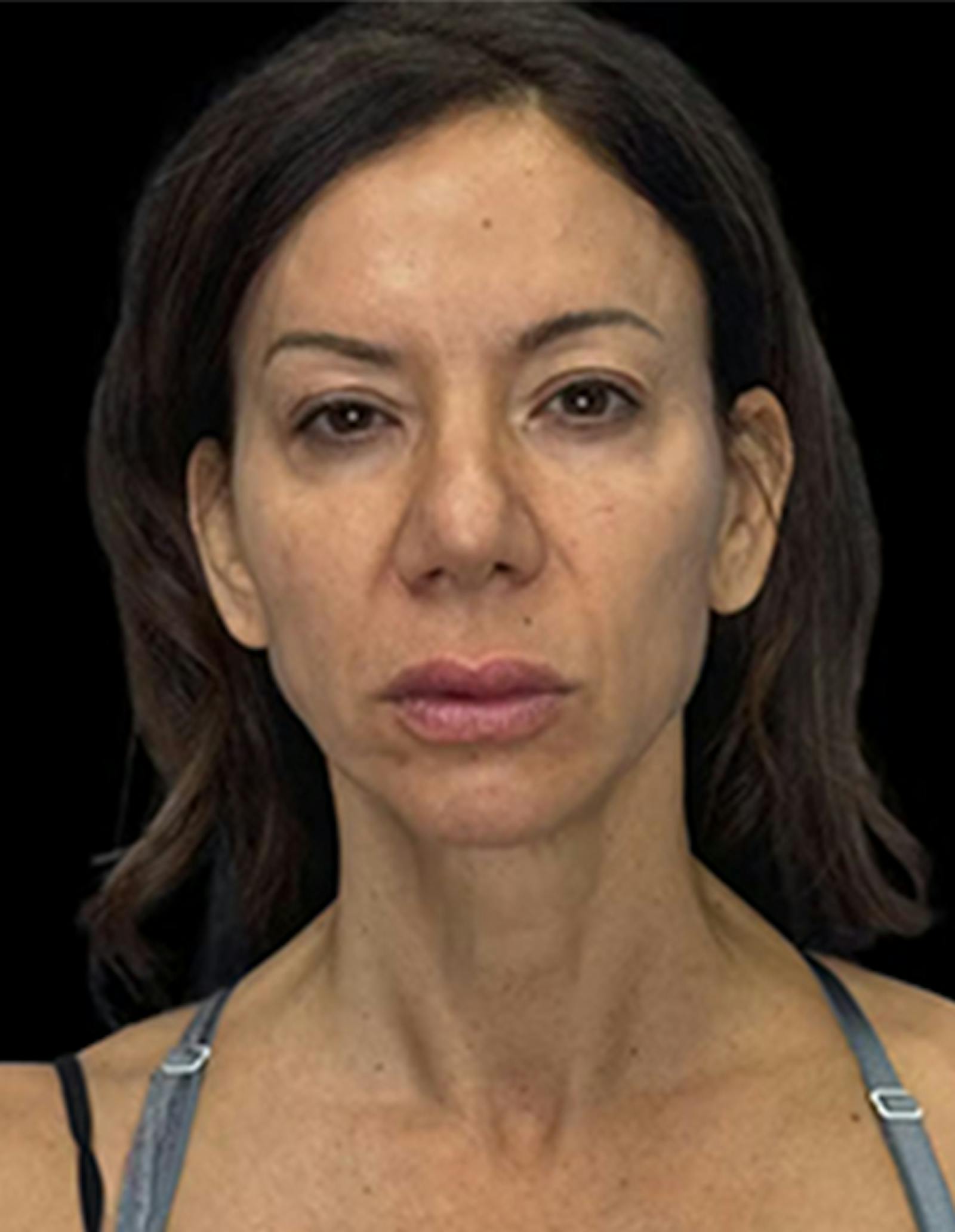 Patient 3, before number 1