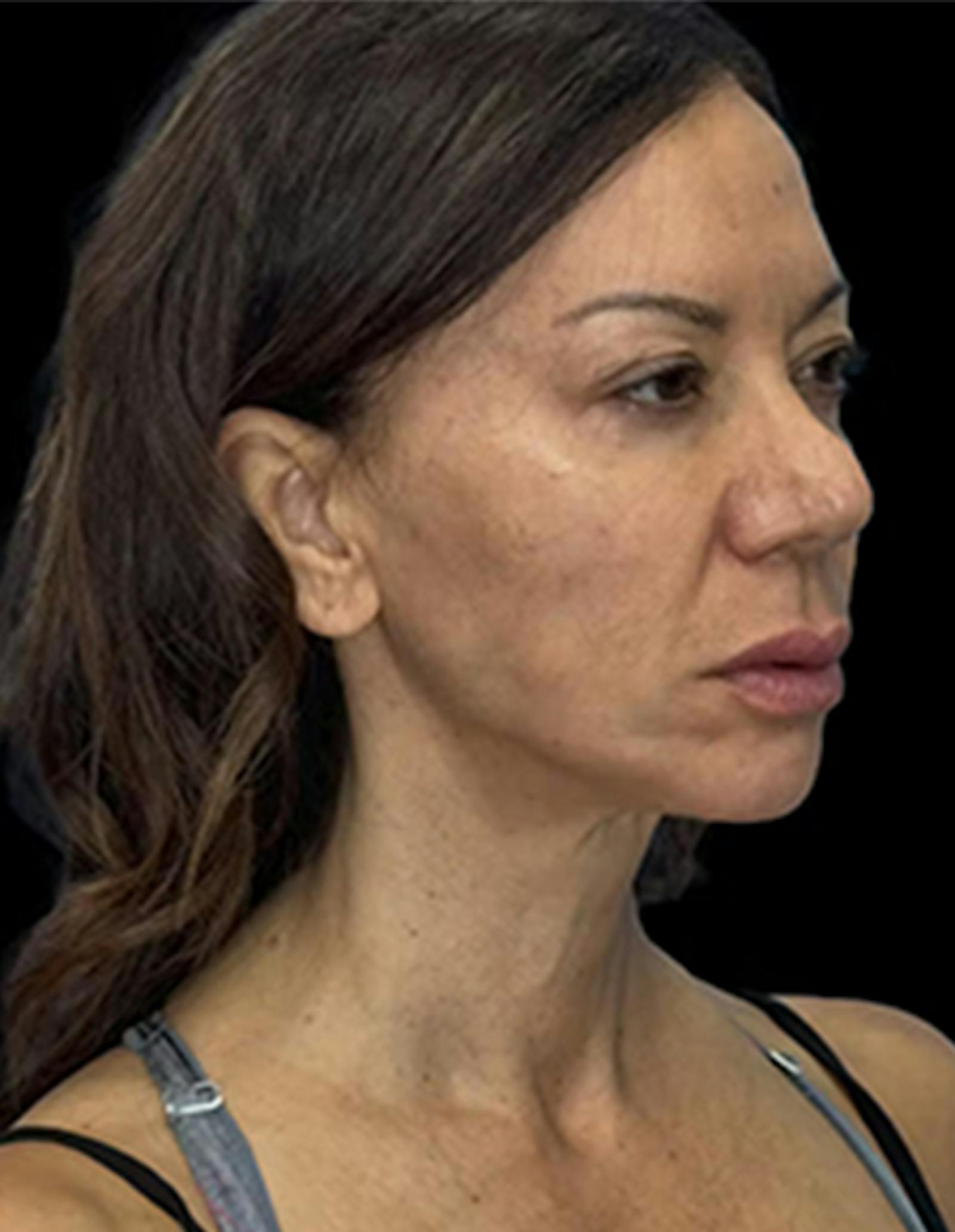 Patient 3, before number 2