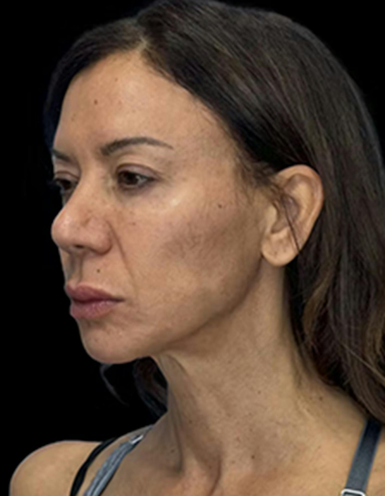 Patient 3, before number 3