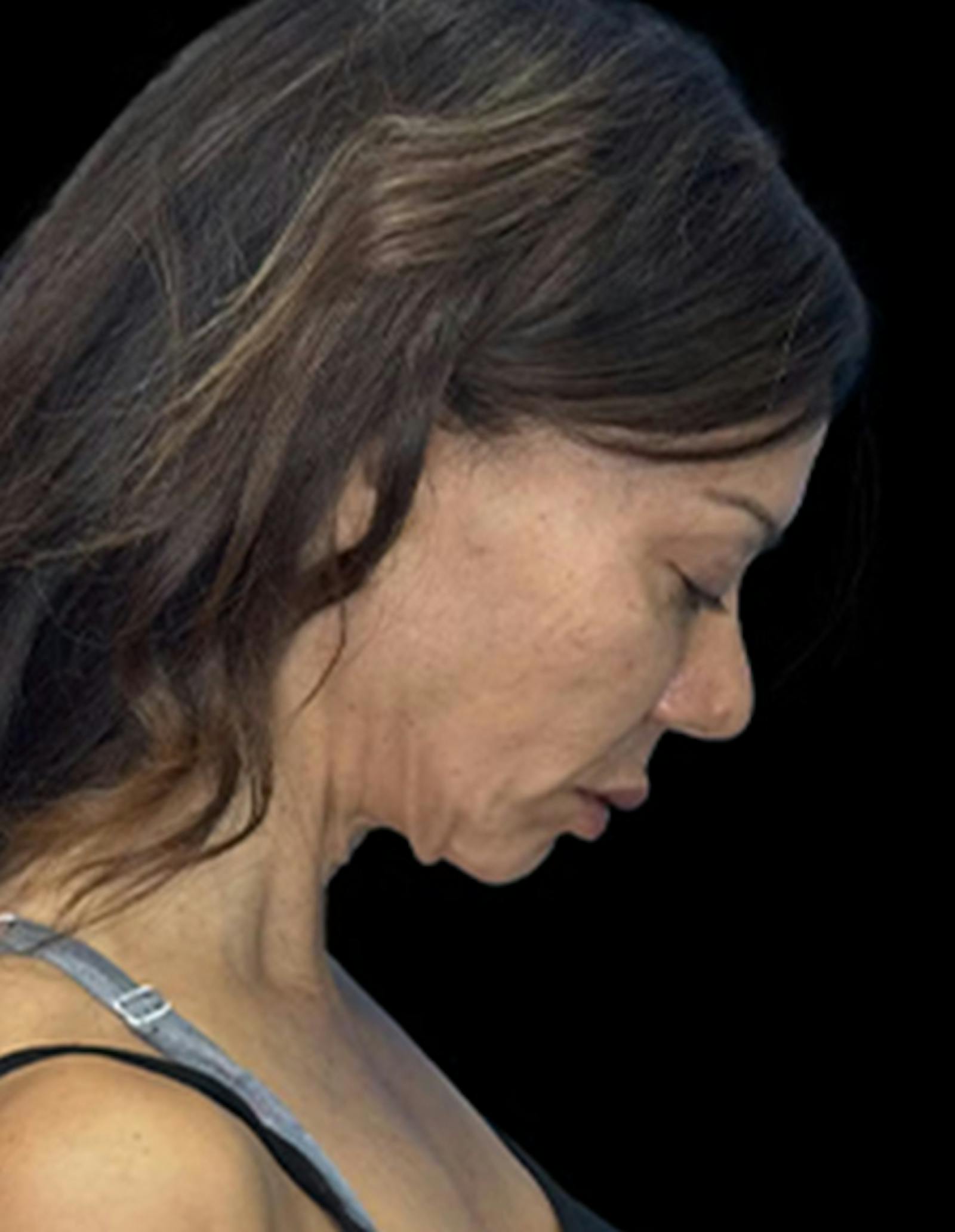 Patient 3, before number 4