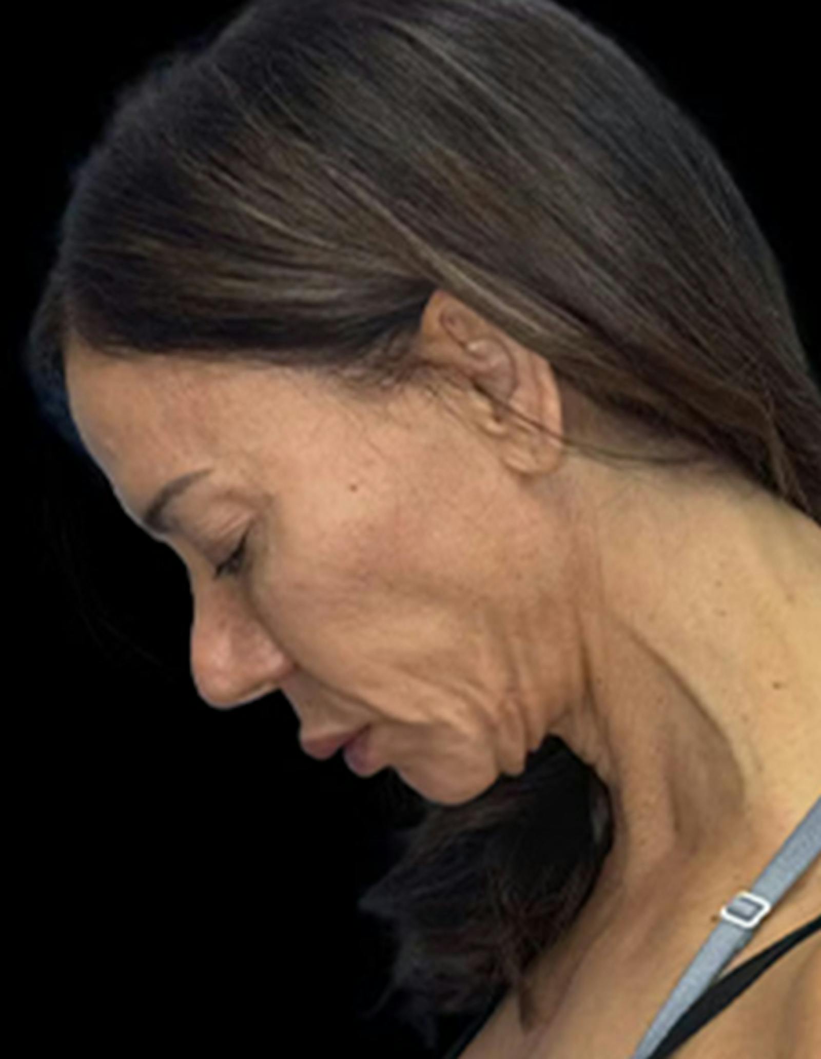 Patient 3, before number 5