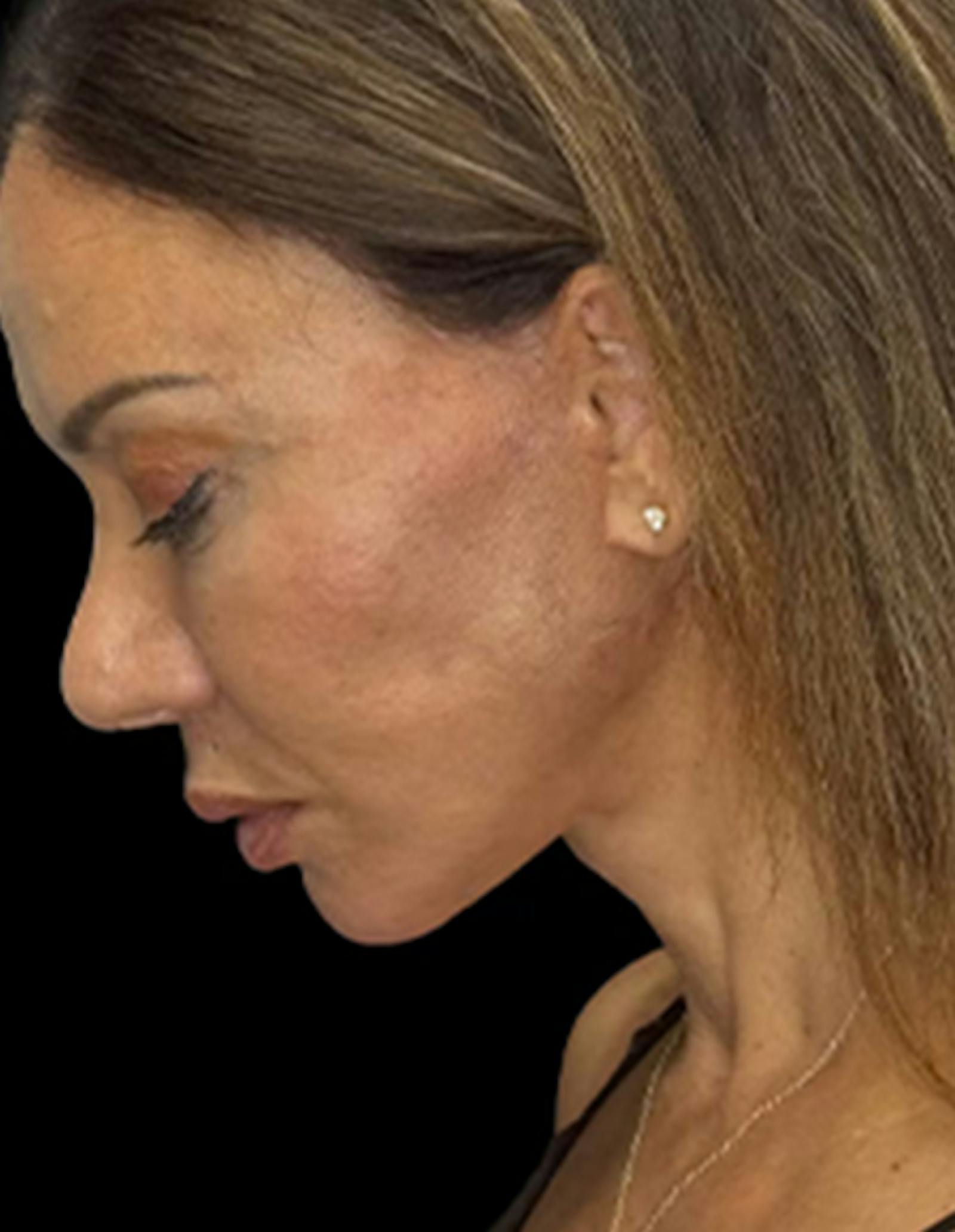 Patient 3, after number 5