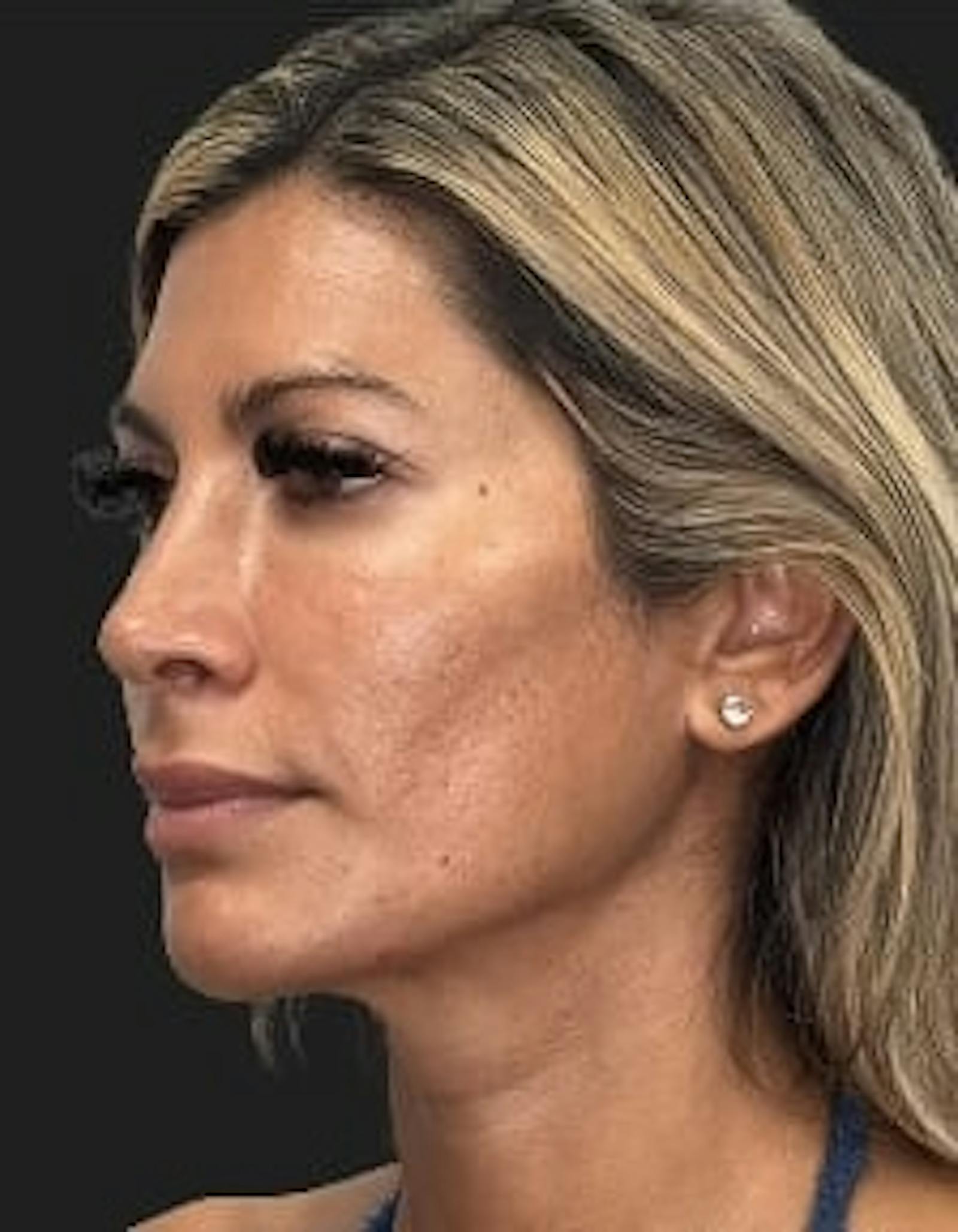 Patient 4, before number 2