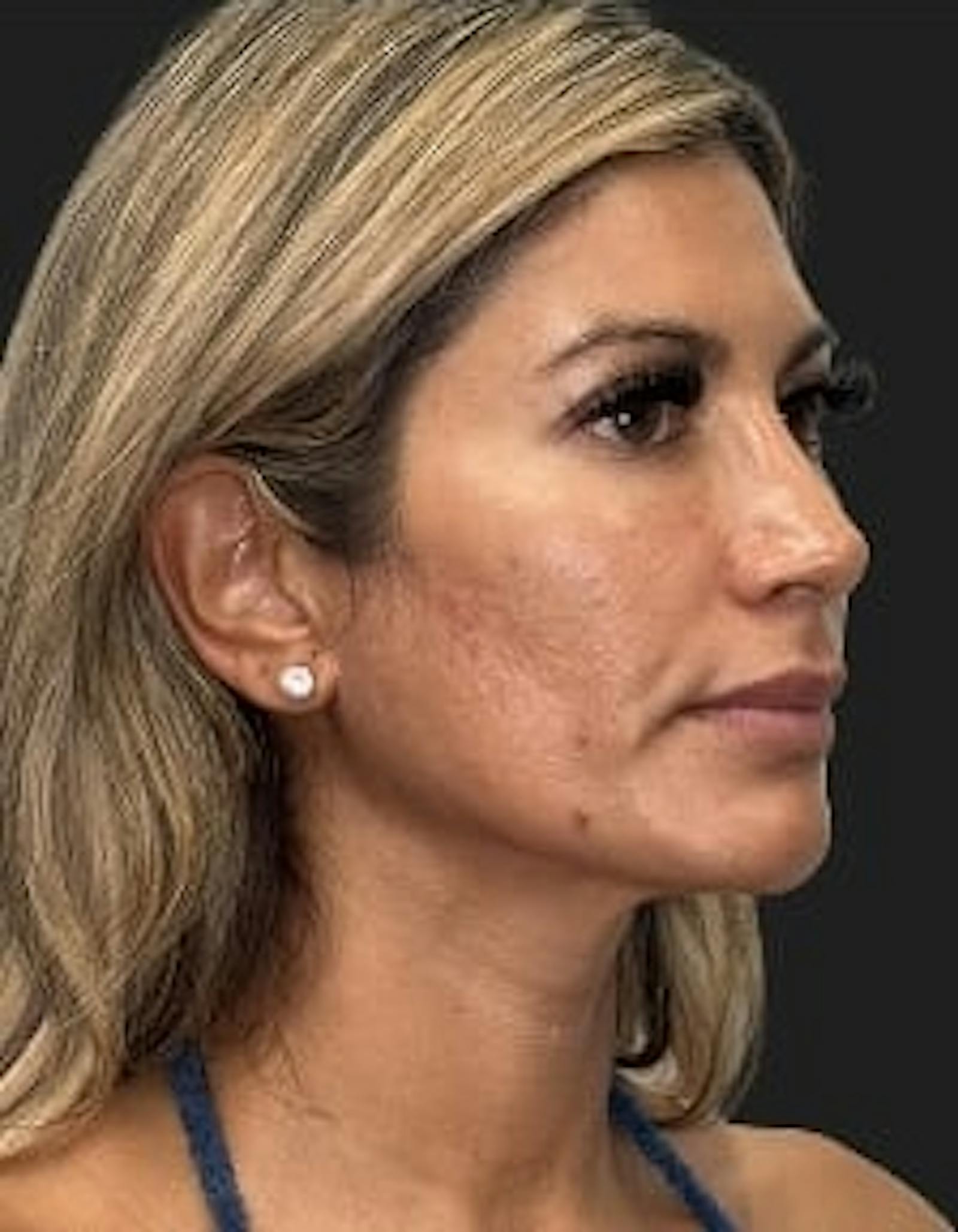 Patient 4, before number 3